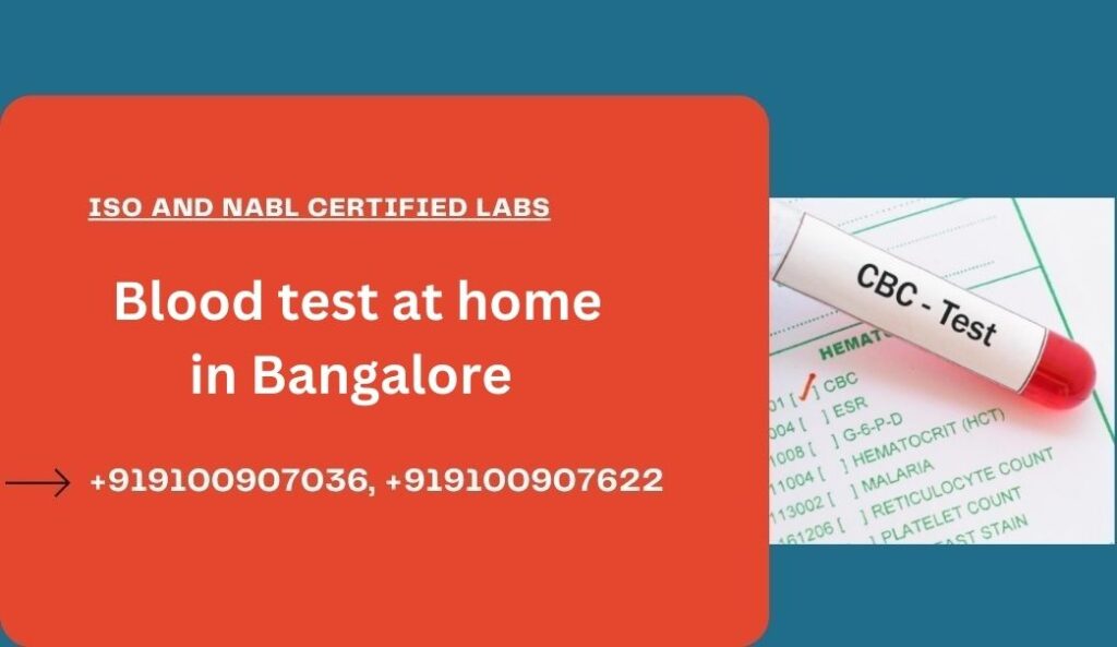 Blood Test in Bangalore