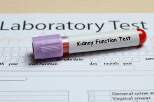 KFT Test