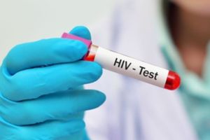 HIV Test