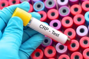 CRP Test
