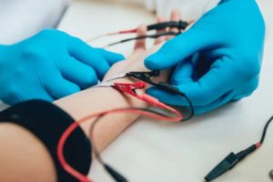 Nerve Conduction Test
